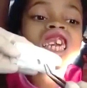 Gusi Bocah 10 Tahun Jadi Sarang Belatung