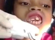 Gusi Bocah 10 Tahun Jadi Sarang Belatung
