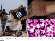 ISIS Dalam Bahaya