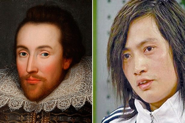 Ingin Mirip William Shakespeare, Pria Rombak Wajah Hingga Rp3 M