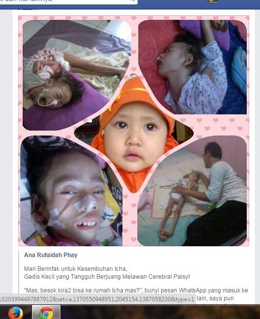 Kasihan, Derita Anak 4 Tahun yang Terserang Lumpuh Otak 