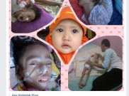 Kasihan, Derita Anak 4 Tahun yang Terserang Lumpuh Otak