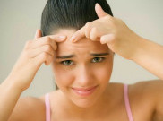 Ini Penyebab Timbulnya Jerawat saat Menstruasi