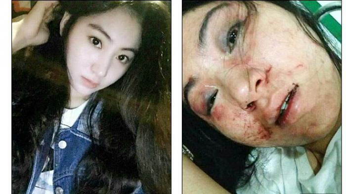 Sadis, Gadis Cantik Digigit dan Dipukuli Bosnya