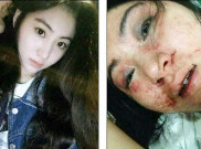 Sadis, Gadis Cantik Digigit dan Dipukuli Bosnya