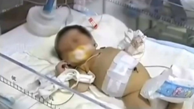 Ajaib, Bayi Baru Lahir Tapi Sudah Mengandung