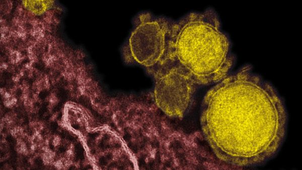 MERS Serang Personel Angkatan Udara Korsel