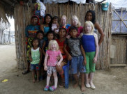 Kepolisian Negara Afrika Timur Tindak Tegas Pembunuh Albino