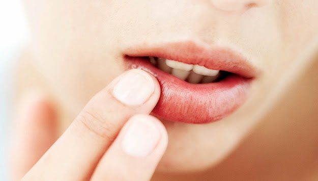 4 Cara Ampuh Atasi Bibir Kering Saat Puasa