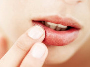 4 Cara Ampuh Atasi Bibir Kering Saat Puasa