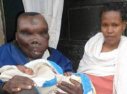 Pria Terjelek di Uganda, 2 Kali Menikah dan Punya 8 Anak