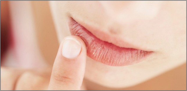 5 Penyebab Bibir Kering dan Pecah-Pecah
