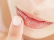 5 Penyebab Bibir Kering dan Pecah-Pecah