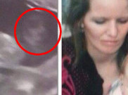 Wanita Ini Lihat Wajah Sang Ibu di Hasil USG Kandungannya