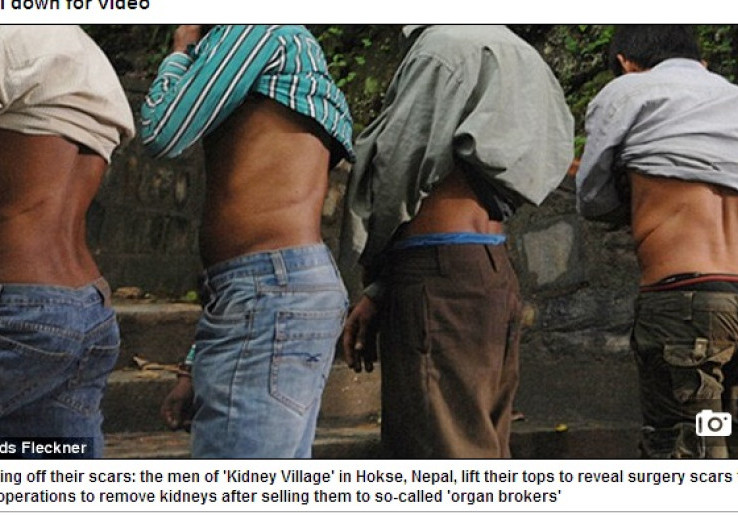 Terlalu Miskin, Warga Desa di Nepal Harus Hidup dengan 1 Ginjal