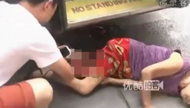 Setelah Kakinya Hancur Terlindas Bus, Nenek Ini Tetap Tenang