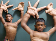 Punya Tangan Raksasa, Bocah 8 Tahun Dijuluki 'Hantu'
