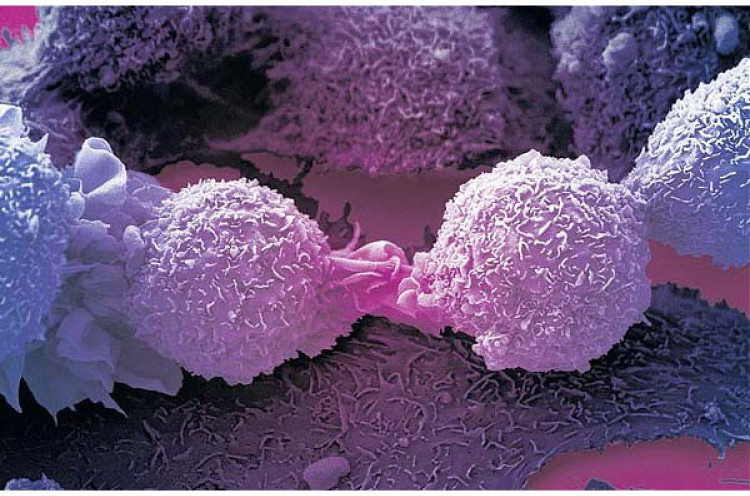 Peneliti Temukan Mekanisme Untuk Kekang Sel Kanker