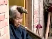 Mengidap Penyakit Langka, Nenek Ini Memiliki Tanduk di Kepala