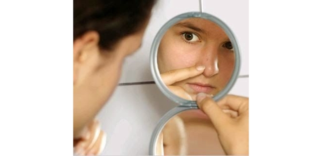 Cara Alami Menghilangkan Komedo dalam Waktu Singkat