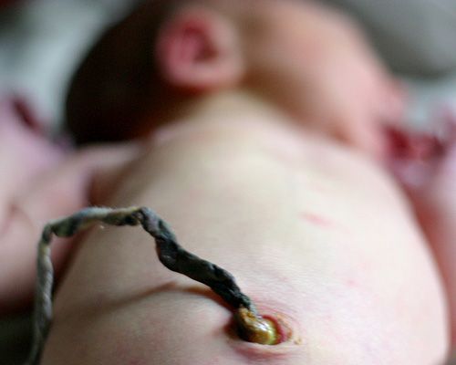 Lotus Birth, Proses Melahirkan Tanpa Memotong Tali Pusat