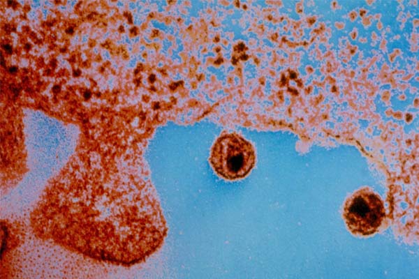 Ilmuwan Dapat Lihat Penyebaran HIV di Tikus