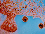 Ilmuwan Dapat Lihat Penyebaran HIV di Tikus