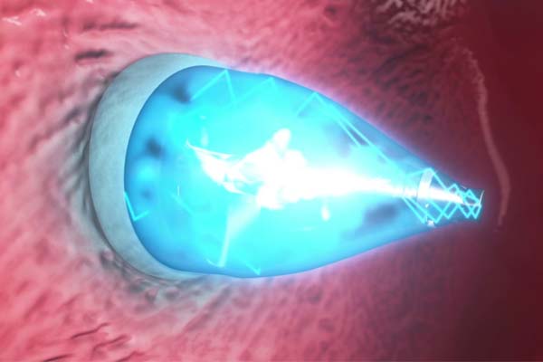 Ilmuwan dapat Tutup Lubang Jantung dengan Sinar Ultra Violet