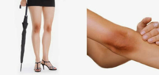 Bahan Alami untuk Mencerahkan Kulit Siku dan Lutut Hitam