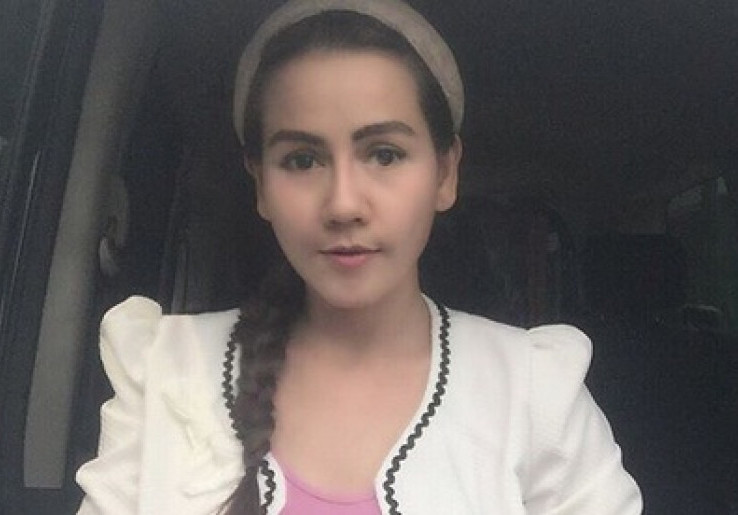 Dibully Haters Karena Operasi Plastik, Nita Thalia Tanggapi Santai