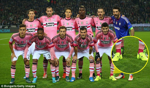 Allegri Geram dengan Kaos Kaki Penyerangnya