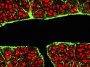 Pertama Kalinya Dokter Membedah Otak untuk Berikan Obat