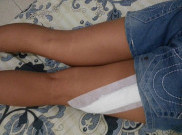 Sadis, Niat Pamer Paha Malah Dibeset Pakai Pisau