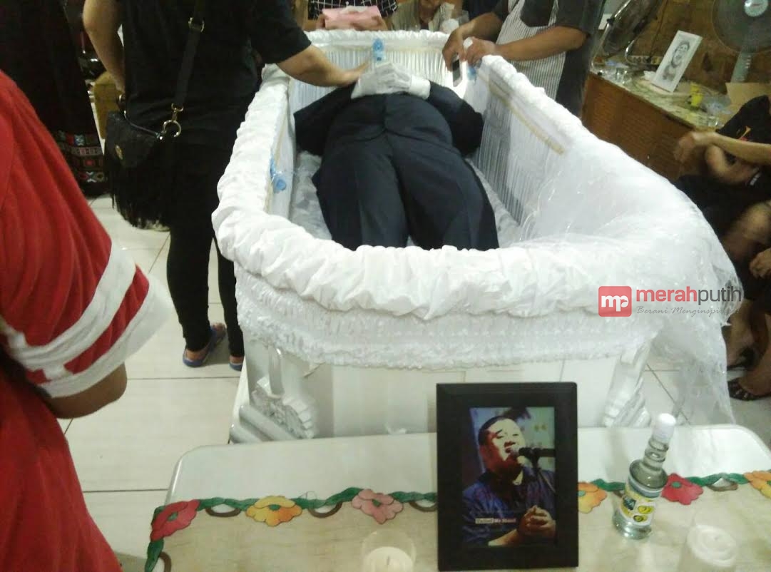 Dokter Belum Memastikan Penyakit yang Diderita Mike Mohede