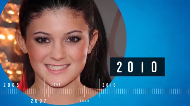 Wow, Perubahan Drastis Wajah Kylie Jenner
