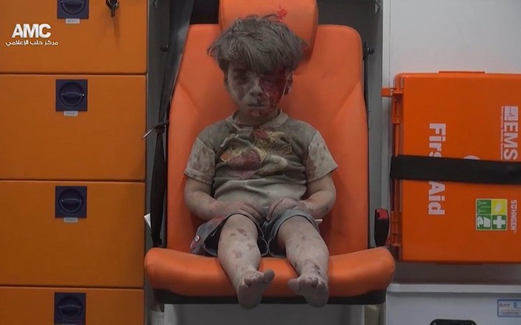 Karena Foto Omran, Rusia Janjikan Gencatan Senjata di Aleppo