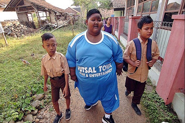 Video Bocah Raksasa Arya Permana Kembali ke Sekolah