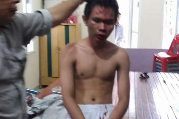 Pelaku Teror Bom Gereja Katolik Medan Terobsesi Pimpinan ISIS