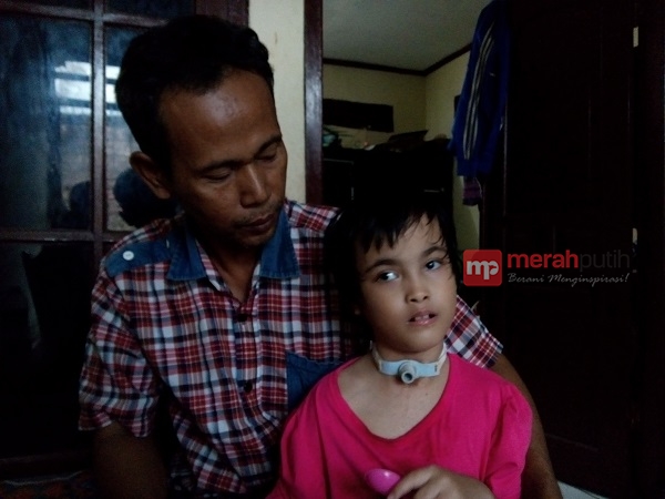 Kisah Pilu Bocah Penderita Hydrocephalus