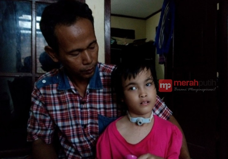 Kisah Pilu Bocah Penderita Hydrocephalus