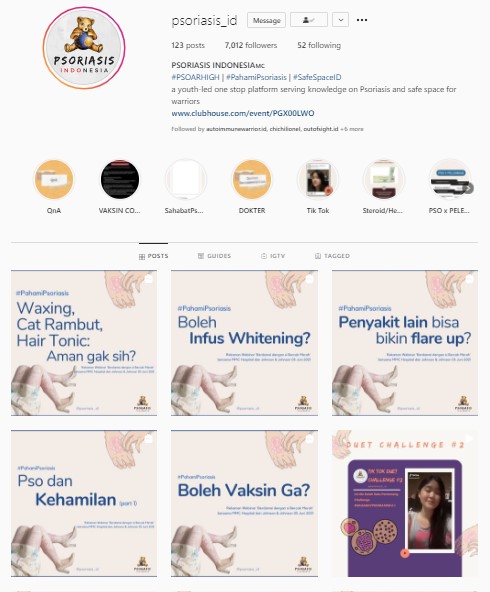 psoriasis