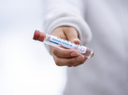 Lonjakan Terus Terjadi, Jumlah Tes PCR di Indonesia Rendah