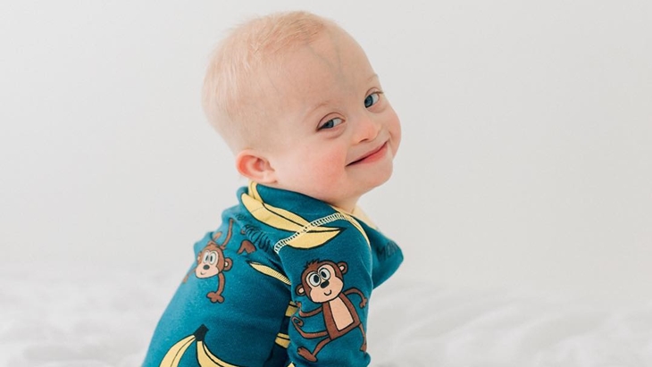 Potret Kebahagiaan Case, Bayi Down Syndrome yang Membuat Kita Semakin Bersyukur
