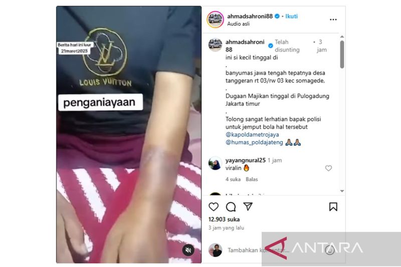 Viral ART Dianiaya Majikan di Pulogadung, Polisi Banyumas Lakukan Penulusuran