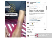 Viral ART Dianiaya Majikan di Pulogadung, Polisi Banyumas Lakukan Penulusuran