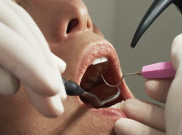 Rutin Periksa Gigi Demi Masa Tua