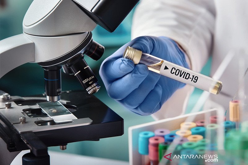 Ilustrasi - Peneliti berupaya menciptakan vaksin virus corona. ANTARA/Shutterstock/am.