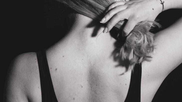 Ternyata Tahi Lalat Bisa Dihilangkan