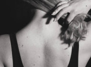 Ternyata Tahi Lalat Bisa Dihilangkan