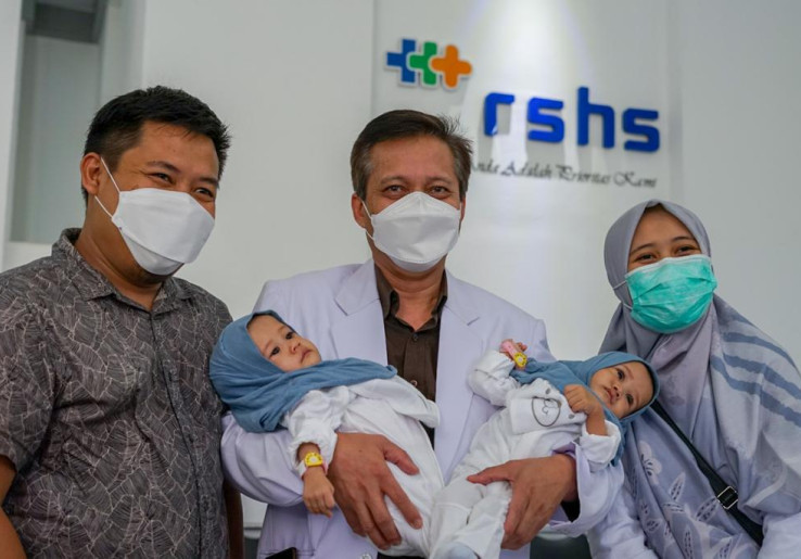 Operasi Pemisahan Berhasil, Kembar Hasna-Husna Mudik ke Kampung Halaman